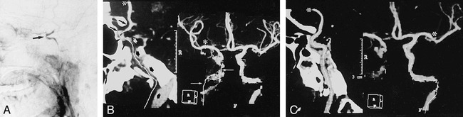 fig 3.