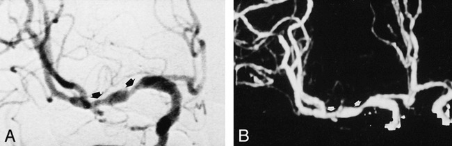 fig 4.