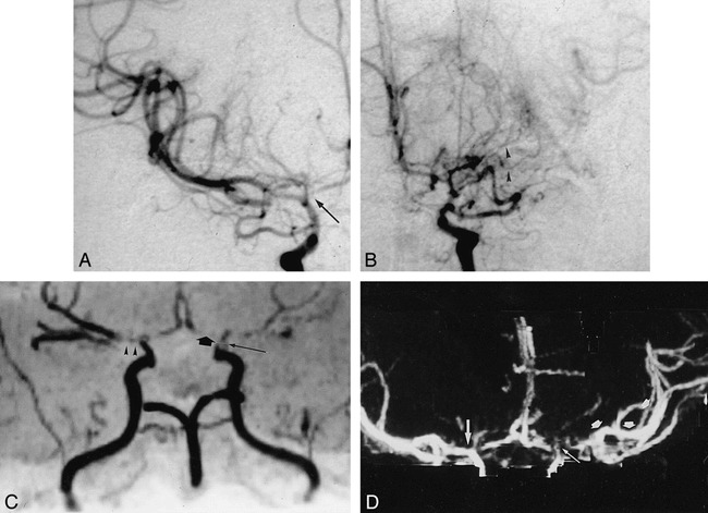 fig 6.