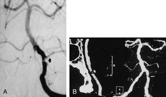 fig 2.