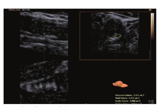 Fig. 4.