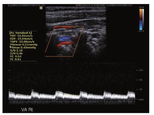 Fig. 6.