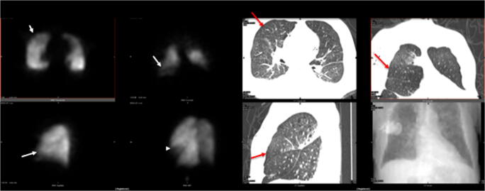 Fig. 2