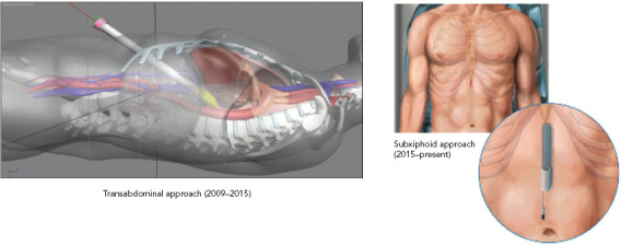 Figure 3: