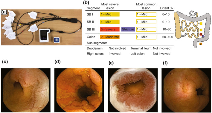 FIGURE 1