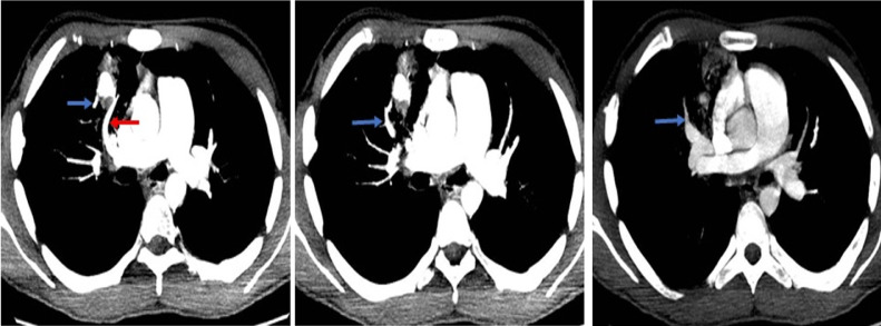 Fig. 2: