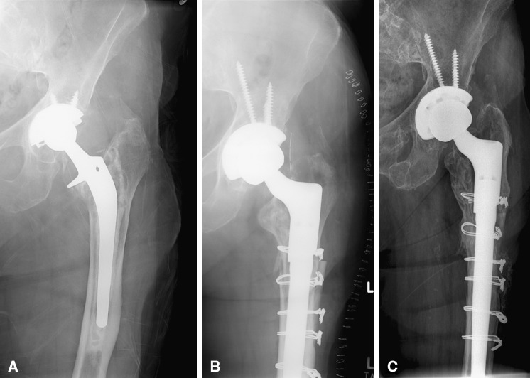 Fig. 1A–C