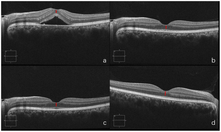 Figure 7