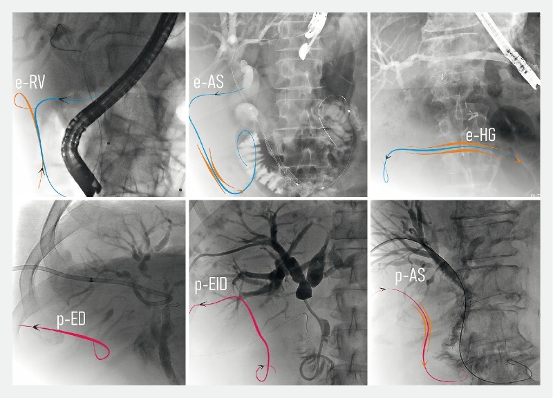 Fig. 2