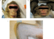 Fig 4