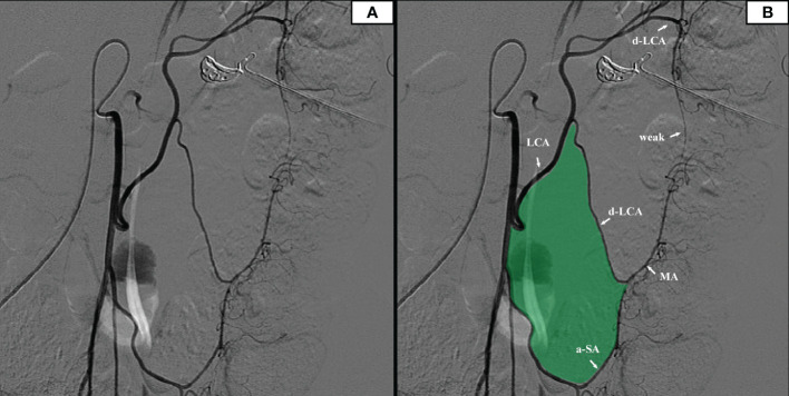 Figure 2