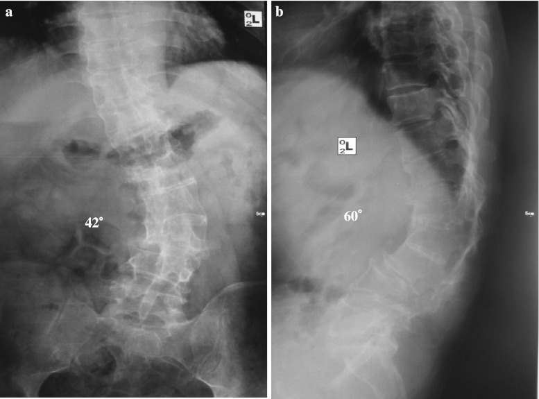 Fig. 1