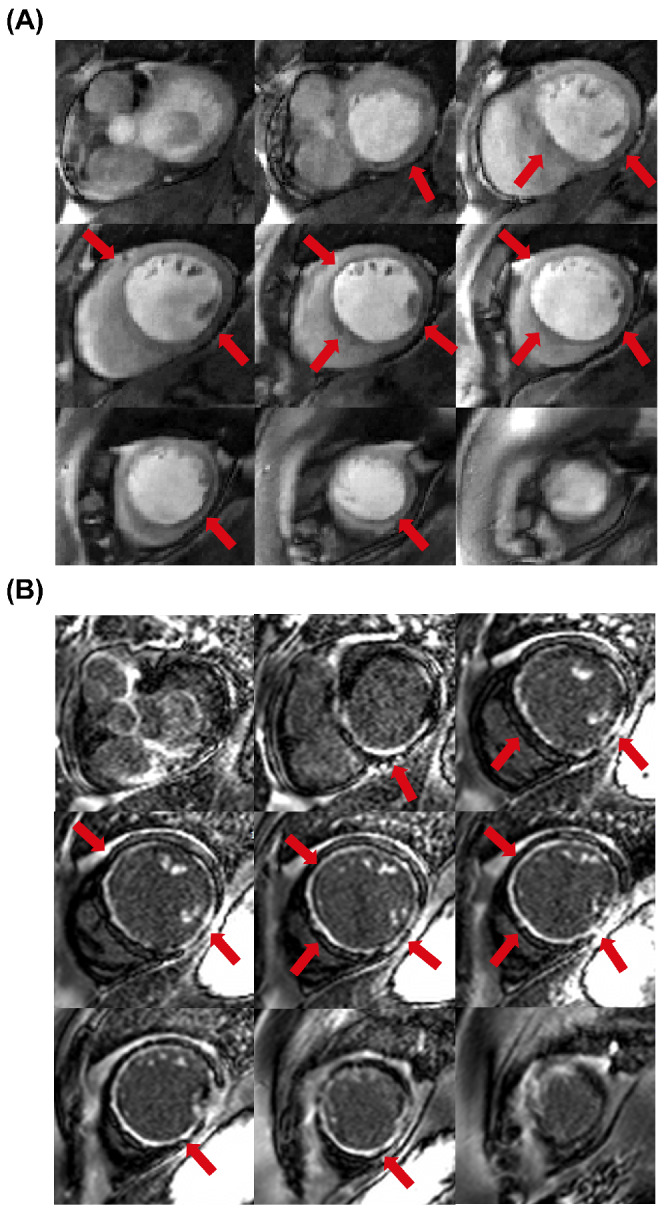 MRM-29229-FIG-0004-c