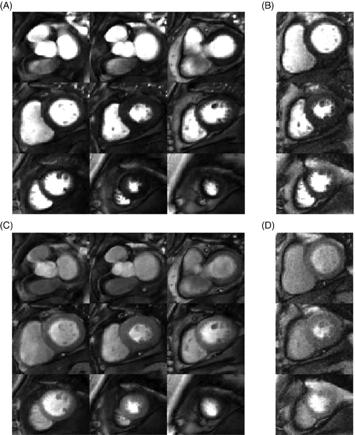 MRM-29229-FIG-0003-b