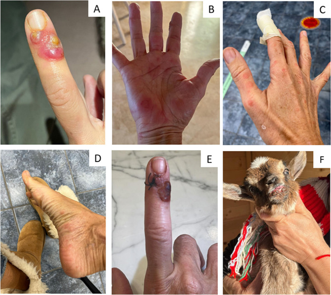 Fig. 1