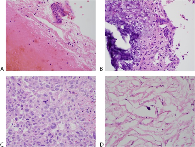 Fig. 1A-D