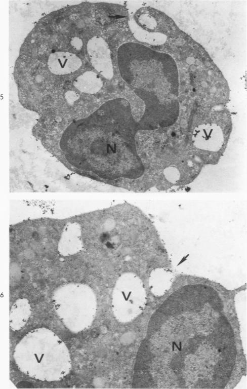 Figs 5 and 6