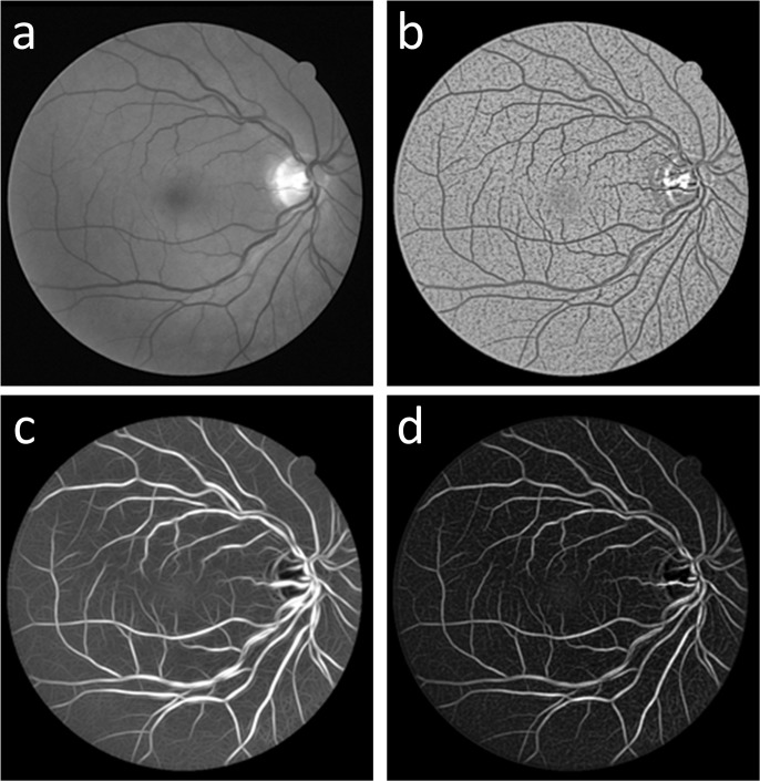 Fig 2