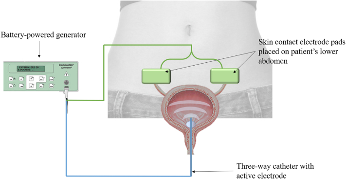 Fig. 3