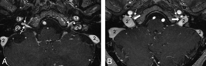 Fig 2.