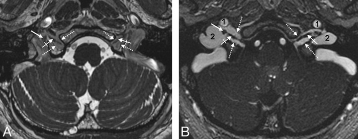 Fig 5.