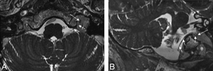 Fig 3.