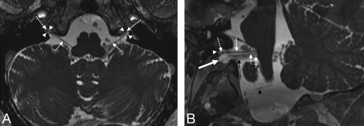 Fig 4.