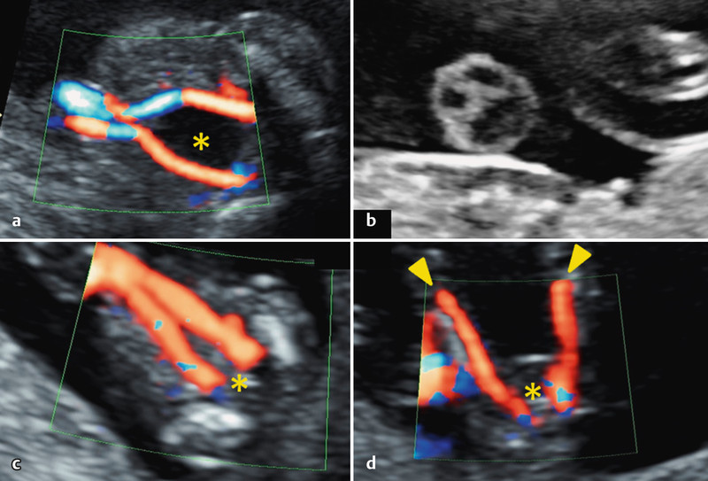 Fig. 7 a