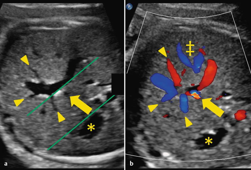 Fig. 9 a