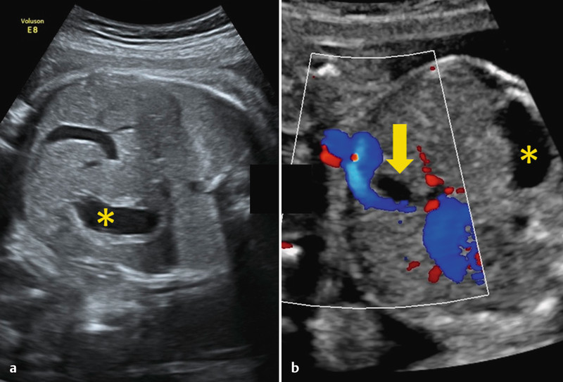 Fig. 10 a