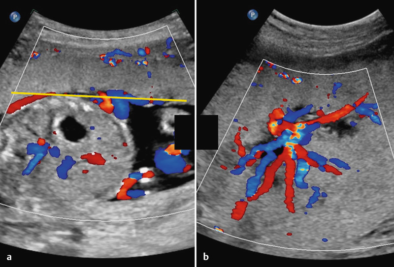 Fig. 3 a