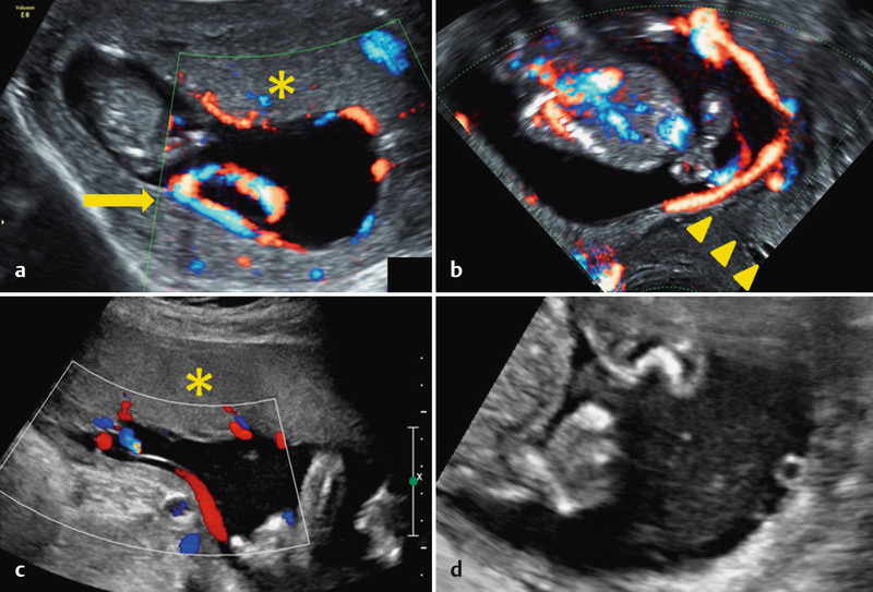 Fig. 4 a