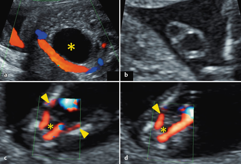 Fig. 8 a