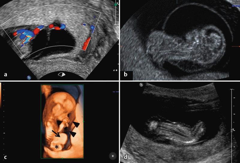 Fig. 2 a