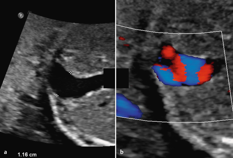 Fig. 11 a