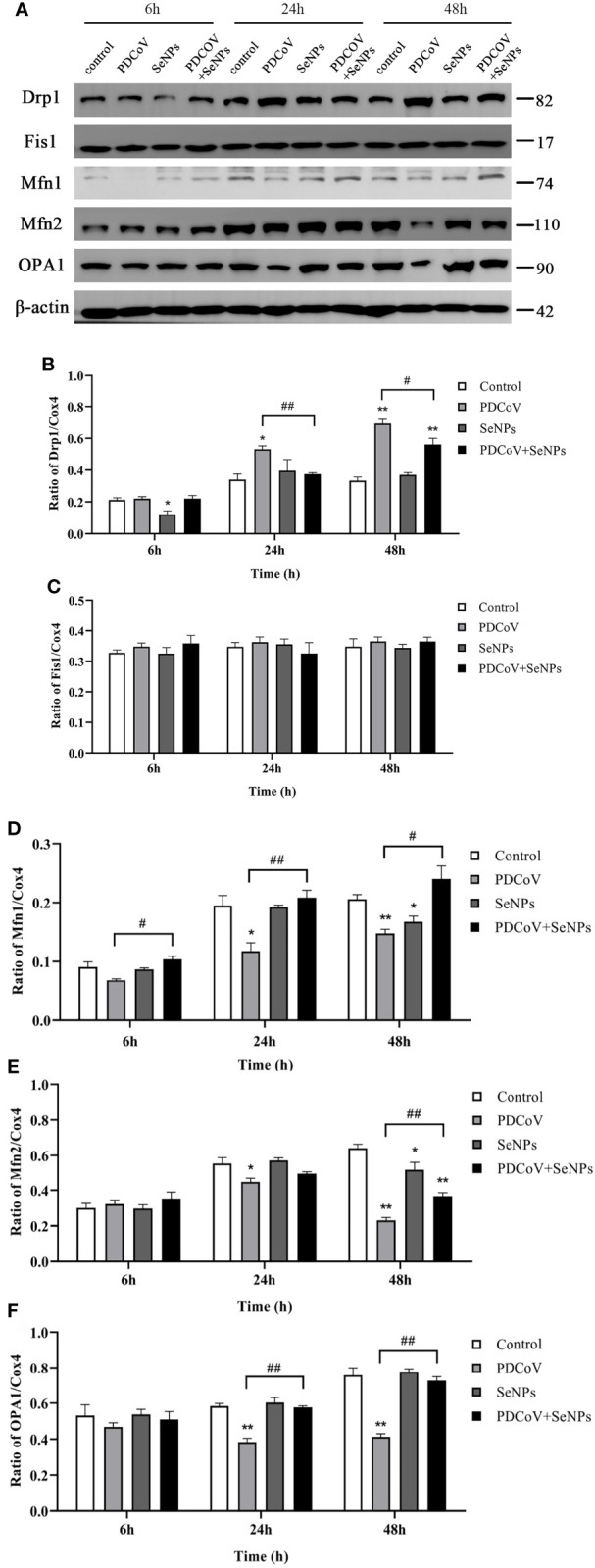 Figure 11