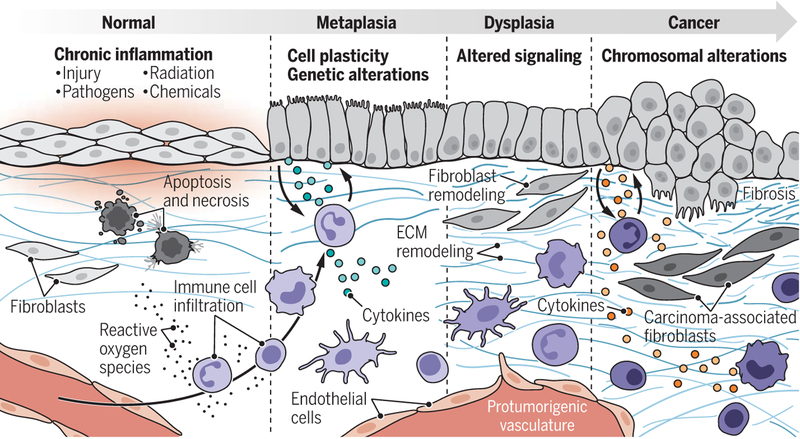 Chronic inflammation–associated cancer pathogenesis