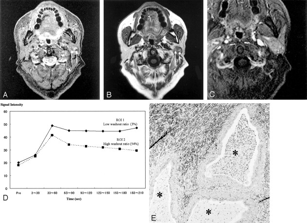 Fig 2.