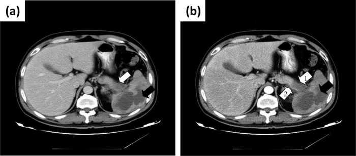 Fig 1