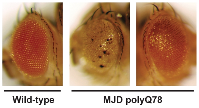 Fruit flies expressing a mutant form of the misfolded human MJD protein (middle) exhibit abnormal eye pigmentation and eye size.