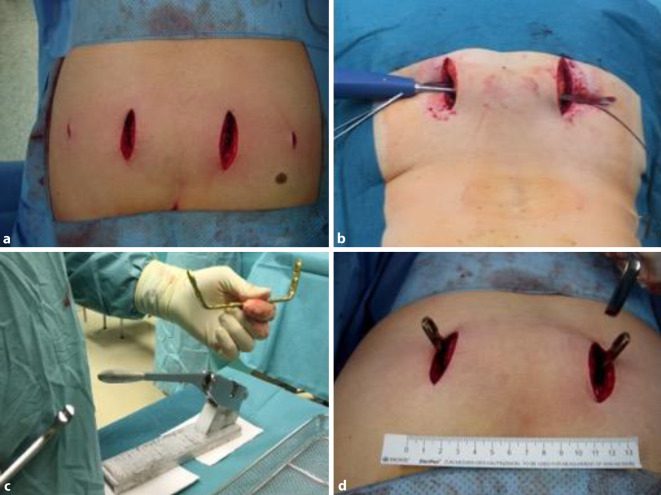 graphic file with name 113_2021_1039_Fig1_HTML.jpg