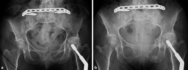 graphic file with name 113_2021_1039_Fig4_HTML.jpg