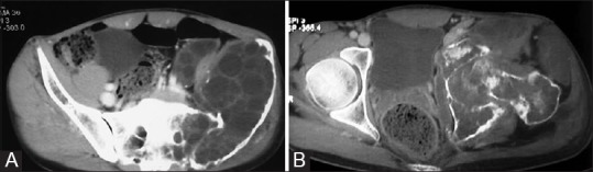 Figure 11 (A and B)