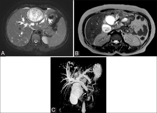 Figure 3 (A-C)