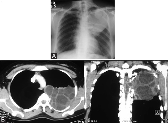 Figure 12 (A and B)