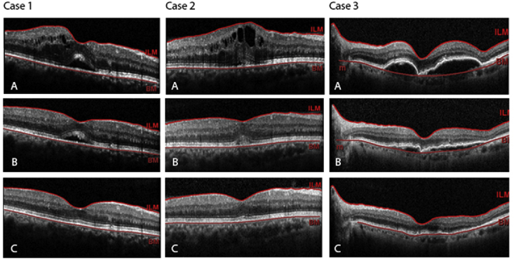 Fig. 1