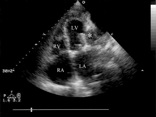 graphic file with name 15FF1.jpg