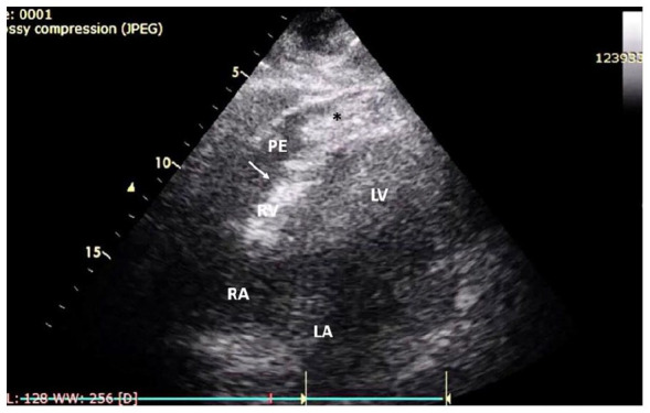 Figure 2.