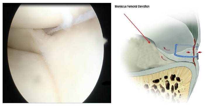 Fig. (1)