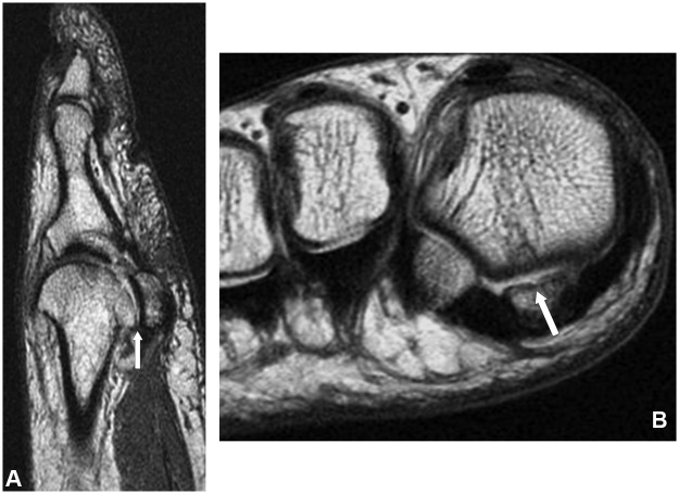 Figure 18.